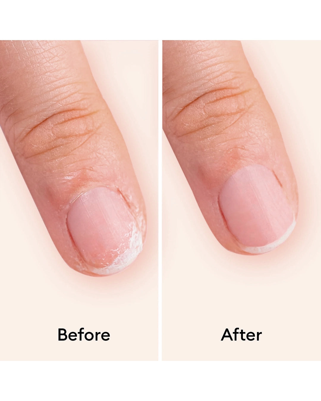Manucurist Treatment - Keratin Booster 15 ml
